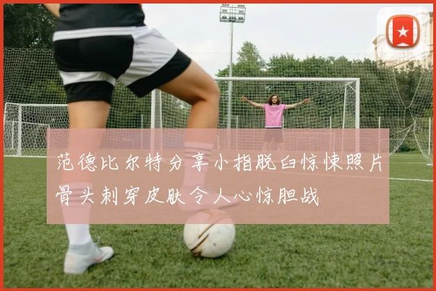 范德比尔特分享小指脱臼惊悚照片骨头刺穿皮肤令人心惊胆战